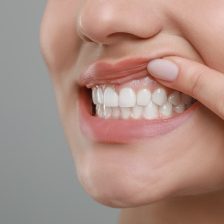 神保町の歯医者、神保町野本歯科医院で歯周組織再生療法の種類と違い|リグロス、エムドゲイン、GTR法どれが正解?について解説