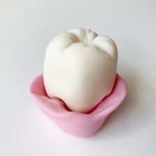 神保町の歯医者、神保町野本歯科医院で、奥歯の歯茎がめくれる原因について解説